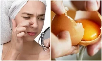 Máscara de Ovo e Fermento Remove Manchas do Rosto – Receita, Como Aplicar e Benefícios