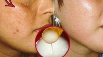 Peeling Facial de Aspirina Com Vinagre de Maçã – Receita, Como Aplicar e Benefícios