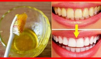Vinagre de Maçã Para Clarear os Dentes – Receita e Como Aplicar