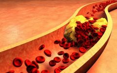 Remédio Caseiro de Gengibre Ajuda Controlar Colesterol – Receita, Como Consumir e Benefícios