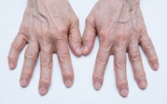 Remédio Caseiro de Salgueiro Trata Artrose – Receita, Como Consumir e Benefícios