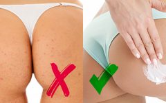 Creme Caseiro Com Aspirina Para Foliculite no Bumbum – Receita e Como Aplicar