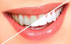 Casca de Laranja Para Clarear os Dentes – Receita e Como Aplicar