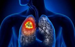 Remédio Caseiro de Arnica Trata Tuberculose – Receita e Como Aplicar
