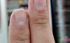 Tratamento Caseiro Elimina Pelinhas nos Dedos – Receita e Como Aplicar
