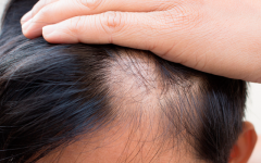 Remédio Caseiro de Cenoura Para Alopecia Areata – Receita e Como Aplicar