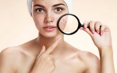 Tratamento com Limão Combate Acne – Receita, Como Fazer e Benefícios