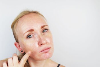 Máscara Facial de Farinha de Aveia Com Ovo Para Oleosidade – Receita, Como Aplicar e Benefícios