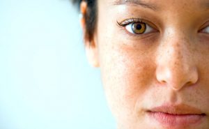 Benefícios do Creme Clariskin Clareador Facial 