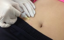 Lipo Injection Contra Gordura Localizada – Como Funciona e Benefícios
