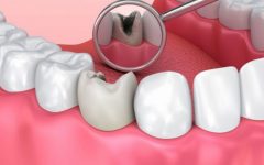 Remédio Caseiro de Óleo Gergelim Ajuda a Tratar Cáries nos Dentes – Receita e Como Aplicar